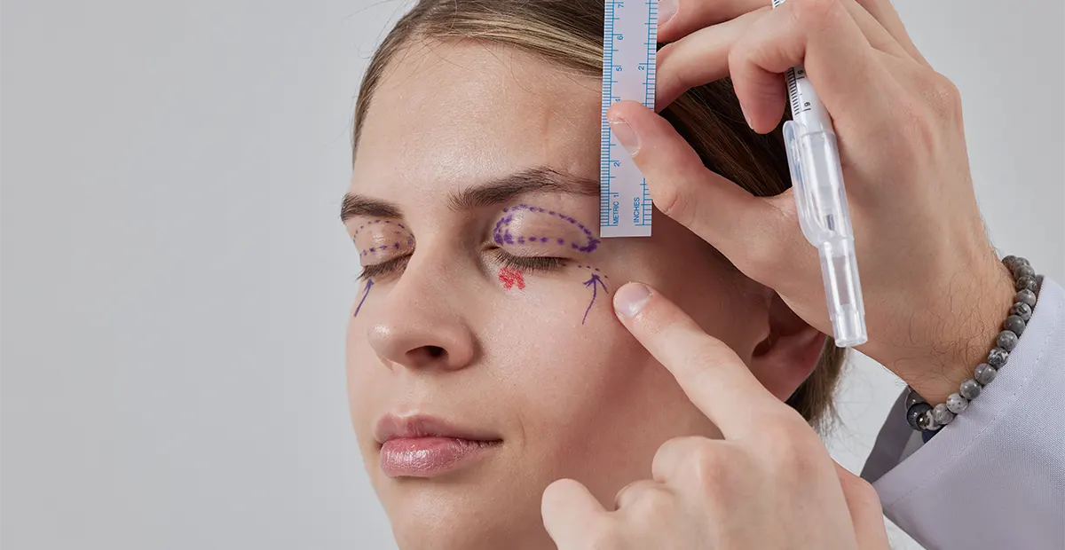 Blefaroplastia